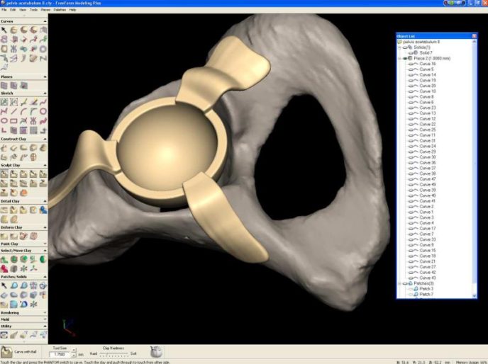 Acetabulum Hip Replacement Model Study